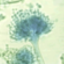 Aspergillus nidulans